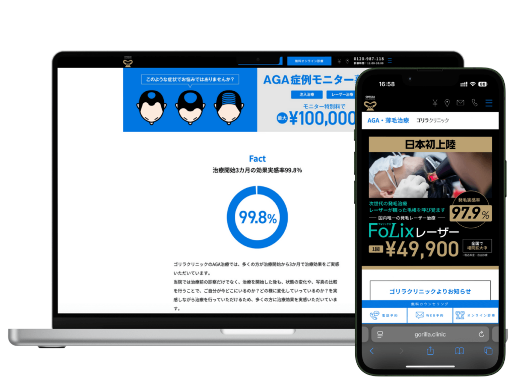 ゴリラクリニックは独自キャンペーンや男性専門で実績が豊富